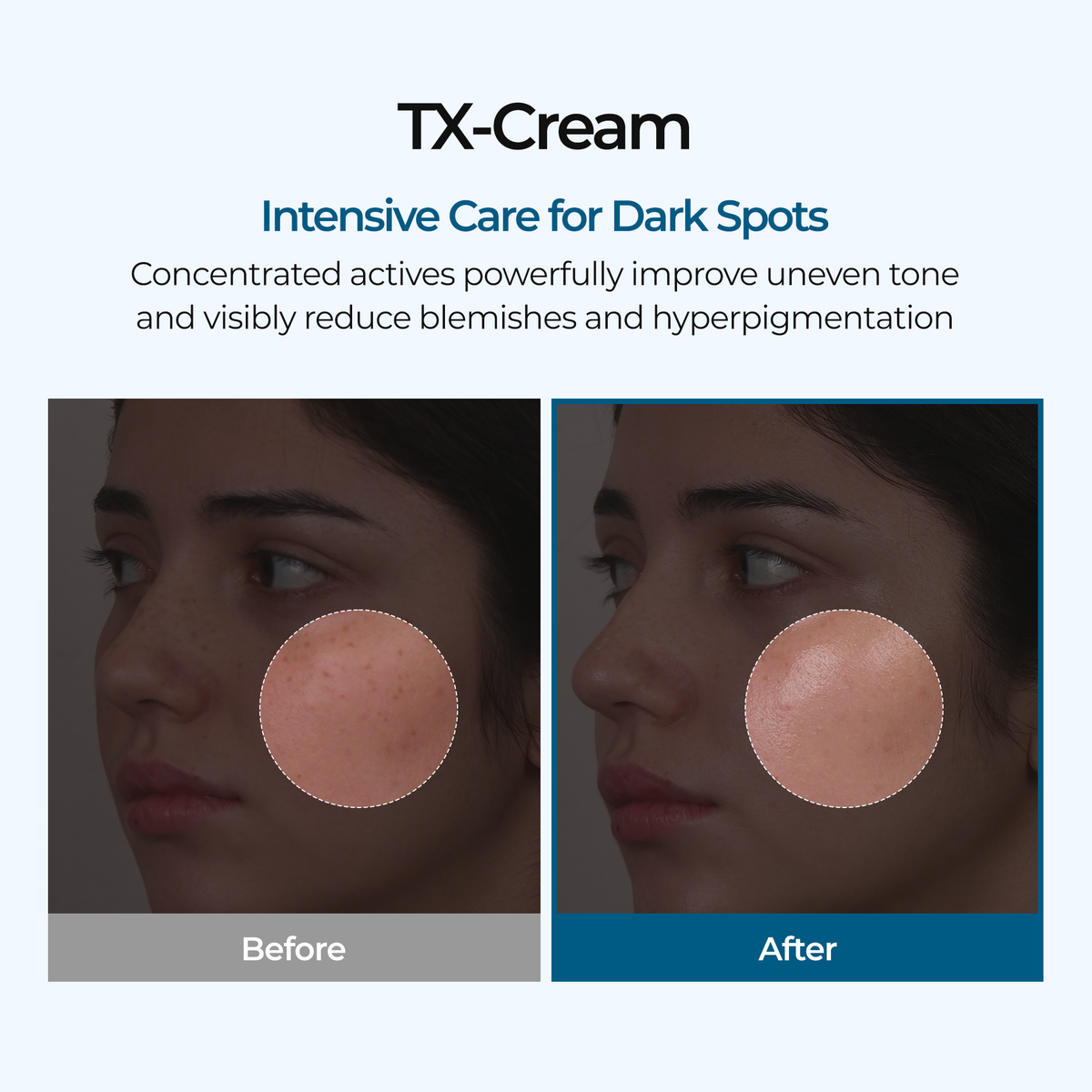 TX Cream - image 3